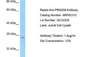 Western Blotting (WB) image for anti-Protease, serine, 58 (PRSS58) (C-Term) antibody (ABIN2789105) (PRSS58 antibody  (C-Term))