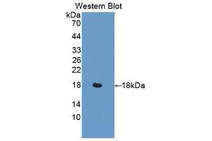 Western blot analysis of the recombinant protein. (LIFR antibody  (AA 641-790))