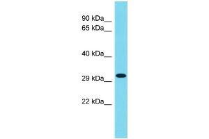 Host: Rabbit Target Name: CCDC75 Sample Type: 293T Whole Cell lysates Antibody Dilution: 1.