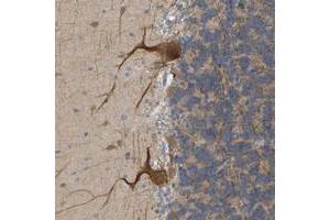 Immunohistochemical staining of human cerebellum with BEND3 polyclonal antibody  shows moderate cytoplasmic positivity in cerebellar tissue.