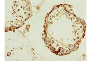 Immunohistochemistry of paraffin-embedded human testis tissue using ABIN7174232 at dilution of 1:100 (UBQLNL antibody  (AA 305-475))
