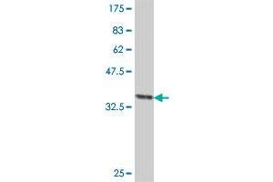 Western Blot detection against Immunogen (37 KDa) . (IQCB1 antibody  (AA 366-464))