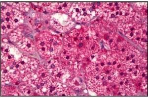 Human Adrenal Cortex: Formalin-Fixed, Paraffin-Embedded (FFPE) (SUCNR1 antibody)