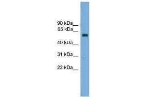 WB Suggested Anti-Zkscan14 Antibody Titration: 0. (ZNF394 antibody  (Middle Region))