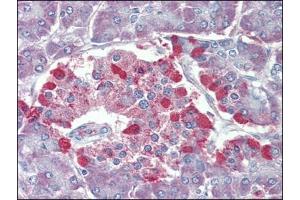 Pancreas, Human: Formalin-Fixed, Paraffin-Embedded (FFPE) (TRPM2 antibody)