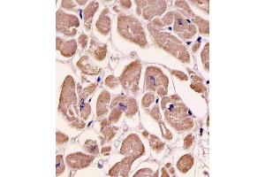 Antibody staining SPHK1 in human heart tissue sections by Immunohistochemistry (IHC-P - paraformaldehyde-fixed, paraffin-embedded sections). (SPHK1 antibody  (AA 286-315))