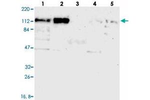 Western blot analysis of Lane 1: RT-4, Lane 2: U-251 MG, Lane 3: Human Plasma, Lane 4: Liver, Lane 5: Tonsil with CEP97 polyclonal antibody  at 1:250-1:500 dilution.