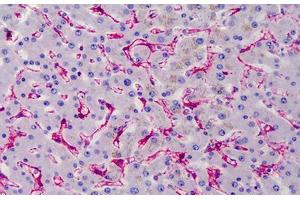 Human Liver: Formalin-Fixed, Paraffin-Embedded (FFPE) (Caveolin-1 antibody)