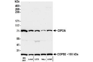 Western Blotting (WB) image for anti-KIAA1524 (KIAA1524) (N-Term) antibody (ABIN7452647)