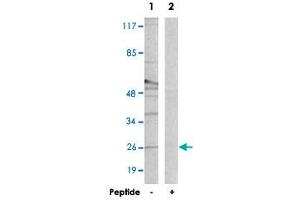 Western blot analysis of extracts from Raw 264. (CREBZF antibody)