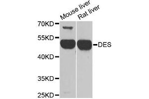 Western blot analysis of extracts of various cell lines, using DES antibody (ABIN1872252) at 1:1000 dilution. (Desmin antibody)