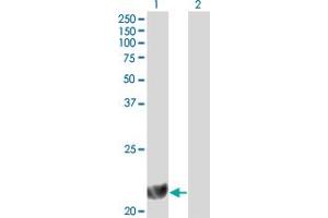 Western Blot analysis of DHFR expression in transfected 293T cell line by DHFR monoclonal antibody (M01), clone 2B10.