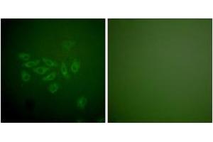 Immunofluorescence analysis of A549 cells, using FHIT Antibody. (FHIT antibody  (AA 81-130))