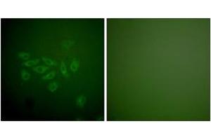 Immunofluorescence analysis of A549 cells, using FHIT Antibody. (FHIT antibody  (AA 81-130))