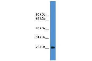 WB Suggested Anti-NUDT16L1 Antibody Titration:  0. (NUDT16L1 antibody  (Middle Region))