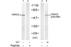 Image no. 1 for anti-Histone Deacetylase 2 (HDAC2) (pSer394) antibody (ABIN319238) (HDAC2 antibody  (pSer394))