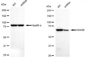 Western blotting analysis using annexin A6 antibody (ABIN7797624). (Recombinant ANXA6 antibody)