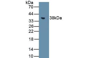 Western blot analysis of recombinant Rat MT1. (MT1 antibody)