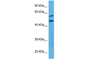 Western Blotting (WB) image for anti-Interferon Regulatory Factor 4 (IRF4) (N-Term) antibody (ABIN2780428)