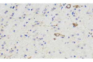 Immunohistochemistry analysis of paraffin-embedded Mouse brain using NOS1 Polyclonal Antibody at dilution of 1:300. (NOS1 antibody)