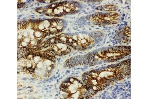 IHC-F: beta Catenin antibody testing of rat intestine tissue (beta Catenin antibody  (AA 764-781))
