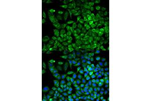 Immunofluorescence analysis of A549 cells using ALDOA antibody (ABIN5970490). (ALDOA antibody)