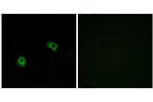 Immunofluorescence analysis of A549 cells, using GPR116 antibody. (G Protein-Coupled Receptor 116 antibody  (C-Term))