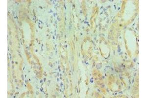 Immunohistochemistry of paraffin-embedded human kidney tissue using ABIN7149618 at dilution of 1:100 (DHRS2 antibody  (AA 1-300))