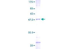 Transgelin Protein (TAGLN) (AA 1-201) (GST tag)