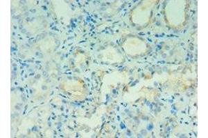 Immunohistochemistry of paraffin-embedded human kidney tissue using ABIN7144131 at dilution of 1:100 (AGT antibody  (AA 35-285))
