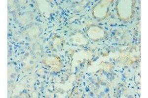 Immunohistochemistry of paraffin-embedded human kidney tissue using ABIN7144131 at dilution of 1:100 (AGT antibody  (AA 35-285))
