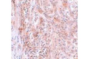 Immunohistochemistry (IHC) image for anti-Breast Carcinoma Amplified Sequence 2 (BCAS2) (C-Term) antibody (ABIN1030285) (BCAS2 antibody  (C-Term))