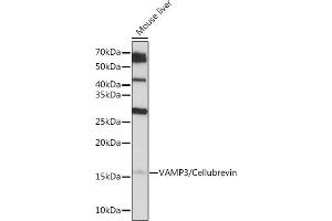 Western blot analysis of extracts of Mouse liver, using V/V/Cellubrevin Rabbit mAb (ABIN7271314) at 1:1000 dilution. (VAMP3 antibody)
