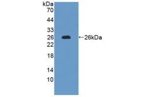 Western blot analysis of recombinant Rat IL12A. (IL12A antibody  (AA 23-215))