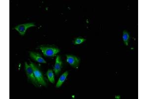 Immunofluorescence staining of A549 cells with ABIN7173786 at 1:100, counter-stained with DAPI. (LTA antibody  (AA 39-281))