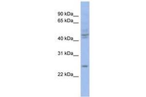 Image no. 1 for anti-PROP Paired-Like Homeobox 1 (PROP1) (C-Term) antibody (ABIN6742802)