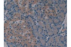 IHC-P analysis of Rat Pancreas Tissue, with DAB staining. (Superoxide dismutase copper chaperone antibody  (AA 27-268))