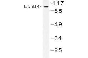 Western blot analysis of EphB4 Antibody in extracts from Jurkat cells. (EPH Receptor B4 antibody)