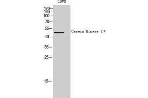 Western Blotting (WB) image for anti-Casein Kinase 1, epsilon (CSNK1E) (Internal Region) antibody (ABIN3174179) (CK1 epsilon antibody  (Internal Region))