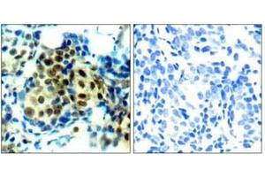 Image no. 3 for anti-Mitogen-Activated Protein Kinase 1/3 (MAPK1/3) (pThr185), (pTyr202) antibody (ABIN196999) (ERK1/2 antibody  (pThr185, pTyr202))