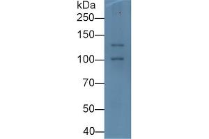 Detection of PIIINP in Rat Pancreas lysate using Monoclonal Antibody to Procollagen III N-Terminal Propeptide (PIIINP) (PIIINP antibody)