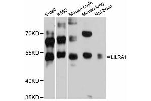 Western blot analysis of extracts of various cell lines, using LILRA1 antibody (ABIN6293167) at 1:3000 dilution. (LILRA1 antibody)