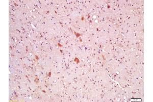 Formalin-fixed and paraffin embedded rat brain labeled with Anti-Wnt8A Polyclonal Antibody, Unconjugated (ABIN762851) at 1:200 followed by conjugation to the secondary antibody and DAB staining (WNT8A antibody  (AA 201-300))