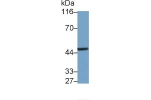 Detection of IRAK4 in Rat Cerebrum lysate using Polyclonal Antibody to Interleukin 1 Receptor Associated Kinase 4 (IRAK4) (IRAK4 antibody  (AA 189-427))