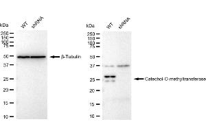 Western blotting analysis using Catechol-O-methyltransferase antibody (ABIN7797922).