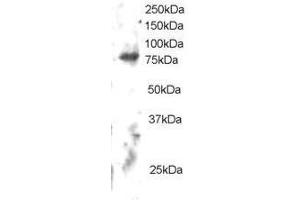 Image no. 1 for anti-Engulfment and Cell Motility 2 (ELMO2) (C-Term) antibody (ABIN374161) (ELMO2 antibody  (C-Term))