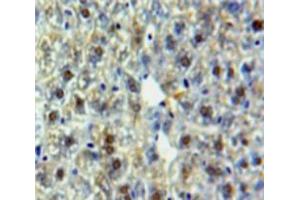 Used in DAB staining on fromalin fixed paraffin-embedded Liver tissue (HSPA9 antibody  (AA 65-311))