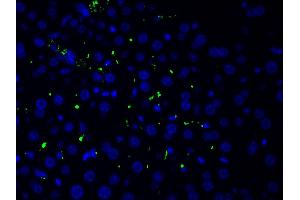 ABIN6267554 at 1/200 staining human liver tissue cells by ICC/IF.