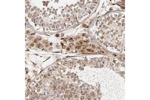 Immunohistochemical staining of human testis with DNAAF2 polyclonal antibody  shows strong cytoplasmic positivity in leydig cells and subsets of cells in seminiferus ducts. (DNAAF2 antibody)