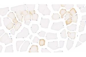 Detection of ALOX15 in Human Skeletal muscle Tissue using Monoclonal Antibody to Arachidonate-15-Lipoxygenase (ALOX15) (ALOX15 antibody  (AA 170-312))
